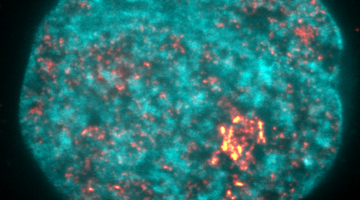 Mittels Superauflösungsmikroskopie aufgenommenes Bild der Transkription in einem Zellkern. 